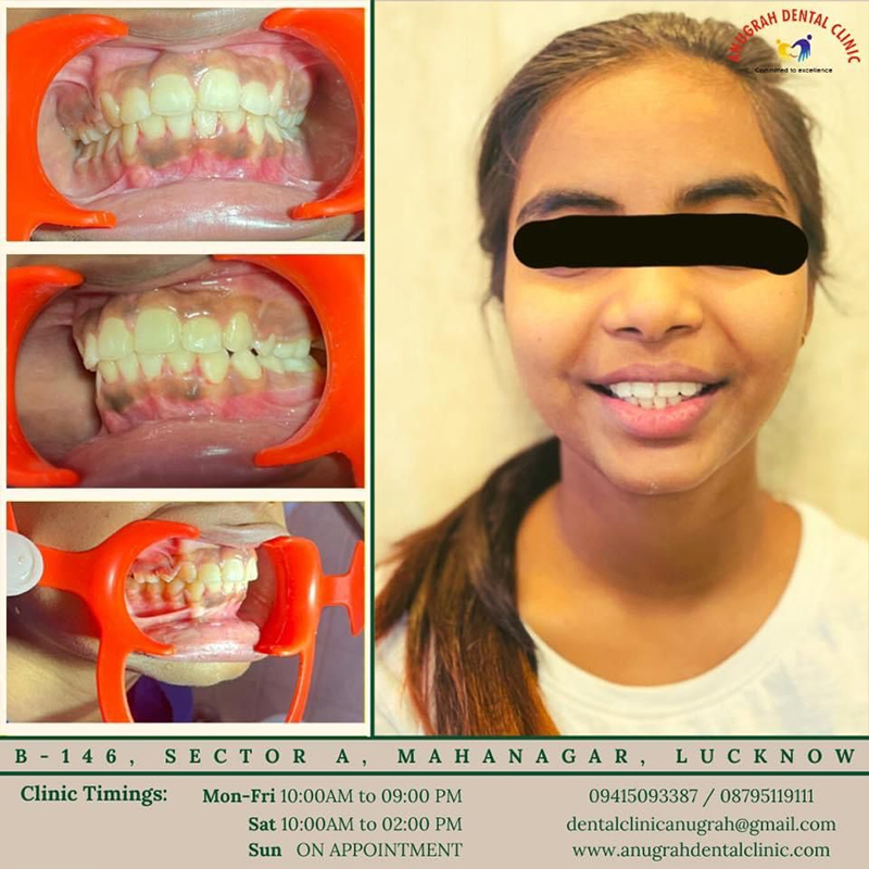 Top 5 Best Orthodontist in Lucknow